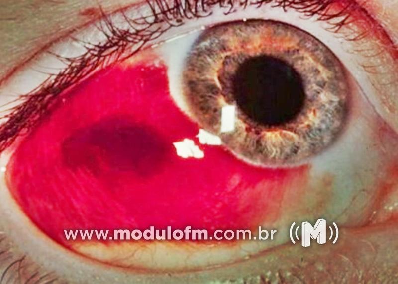 Polícia investiga agressão contra criança de 2 anos em Patrocínio