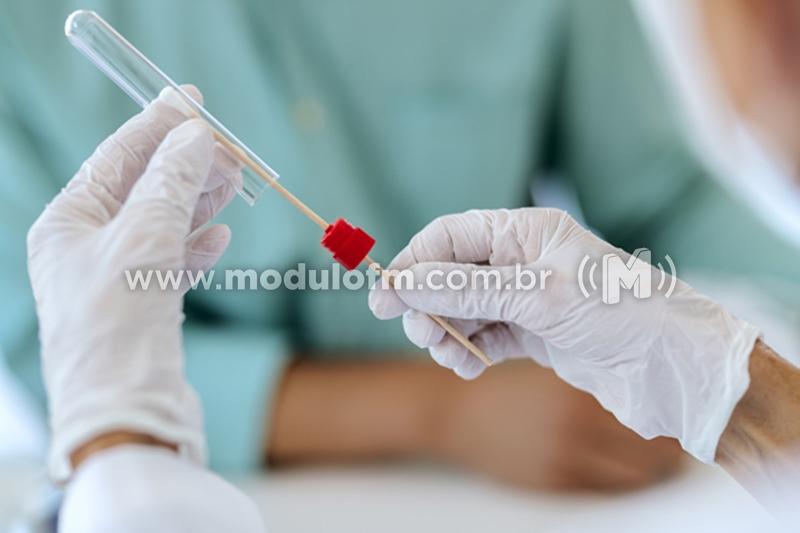 Testes tipo PCR para varíola dos macacos podem ter...